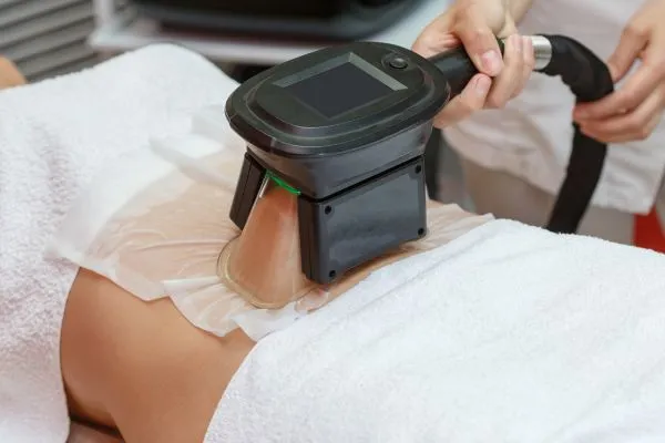 Image of person having fat freezing treatment to help weight gain Hassocks