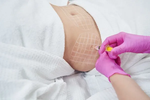 image of fat dissolving injections on love handles to help combat weight gain Hassocks