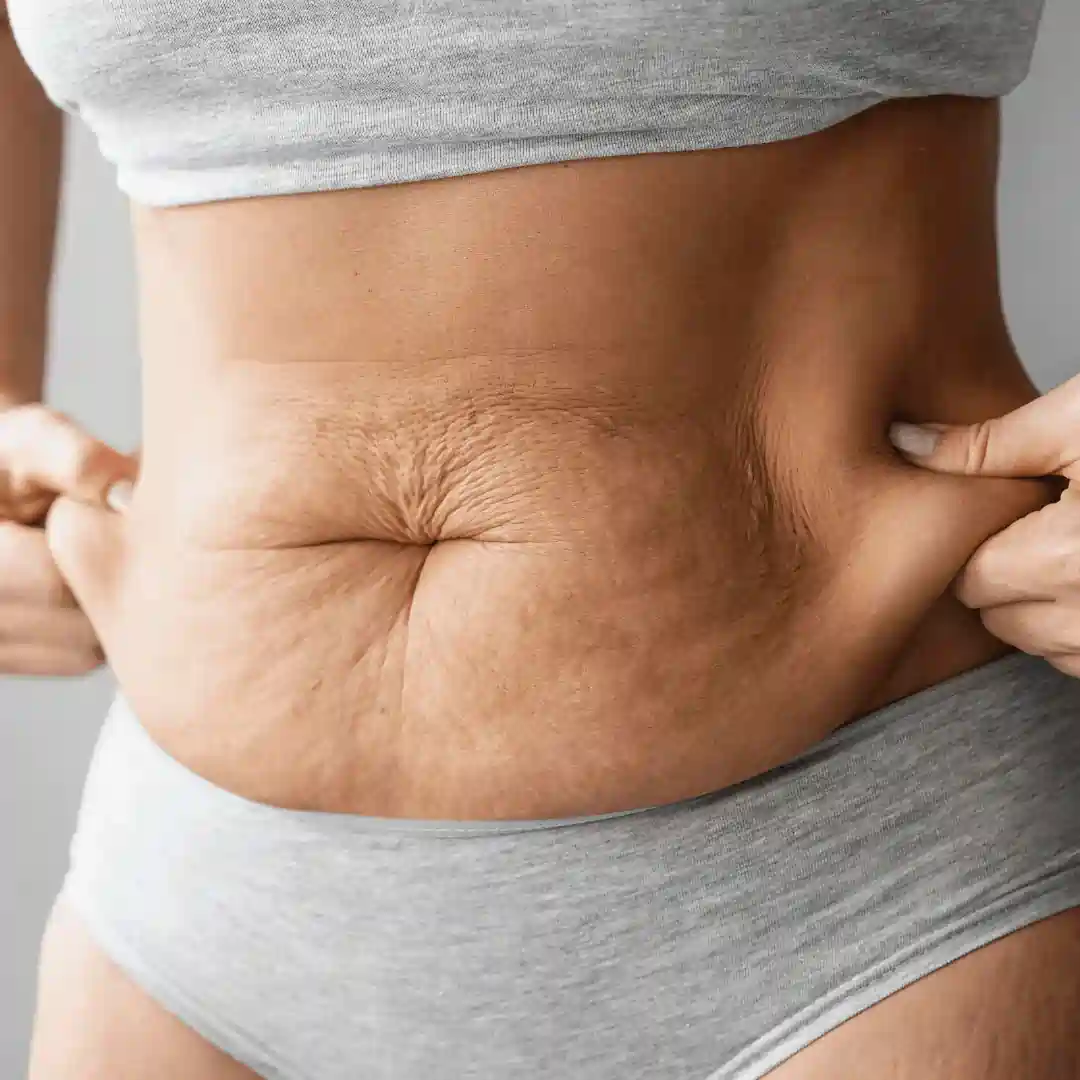Is It Normal to Have Loose Skin After Pregnancy Hassocks?
