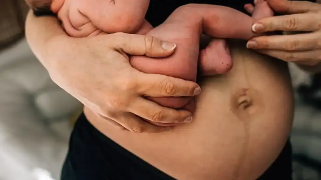 Why Is My Stomach Still Big After Pregnancy Hassocks?